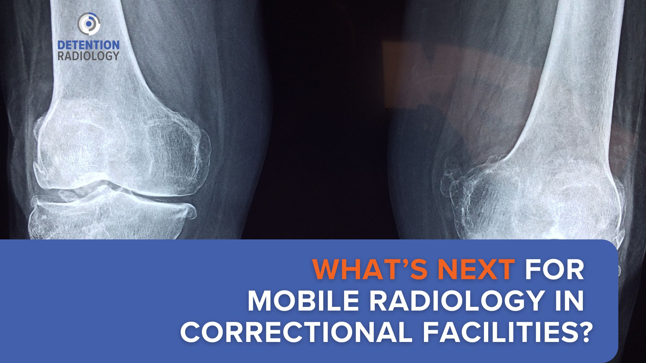 The Future of Correctional Mobile Radiology