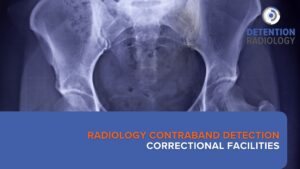 radiology contraband detection correctional