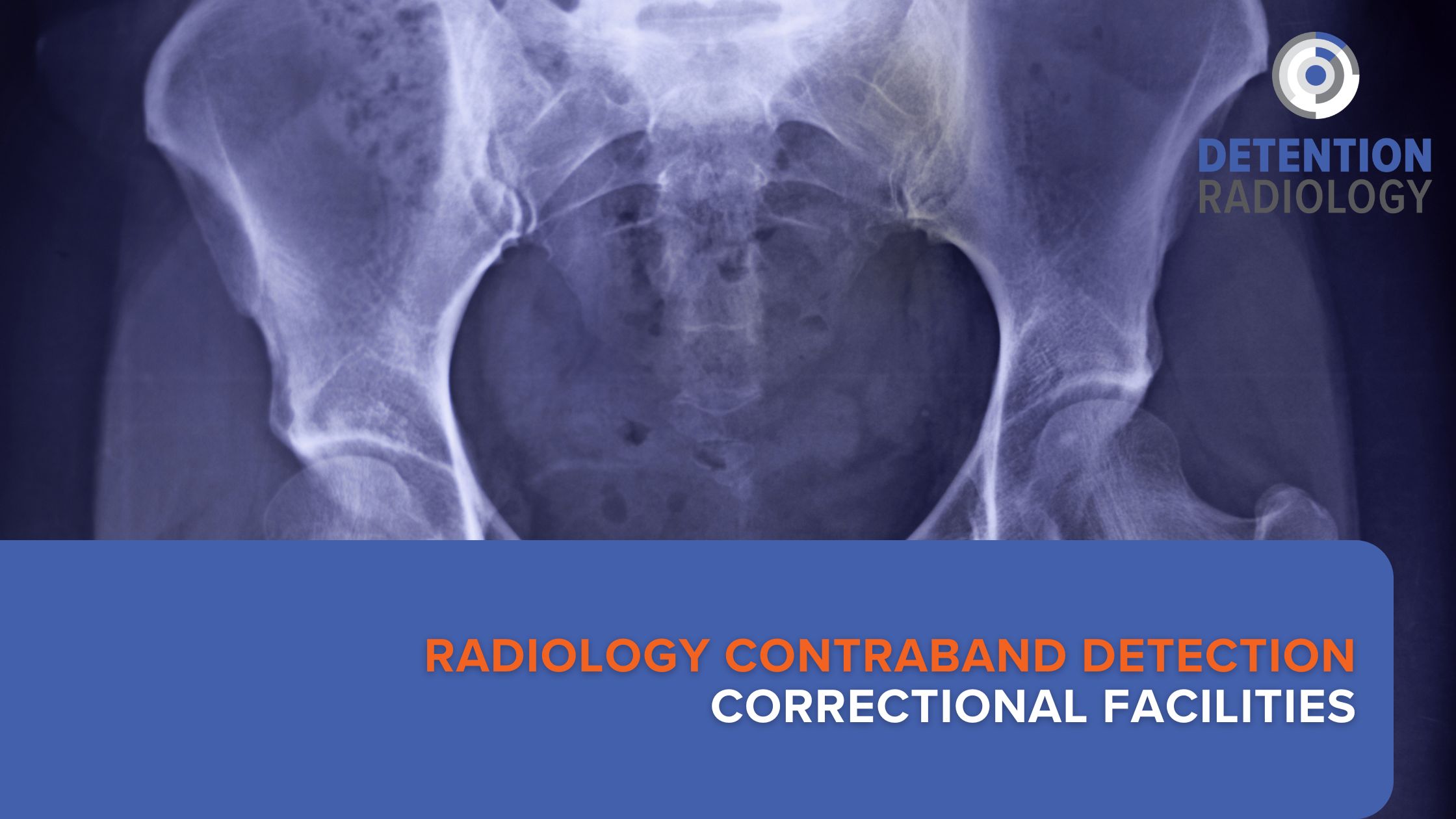 radiology contraband detection correctional